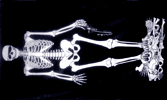 Skeleton